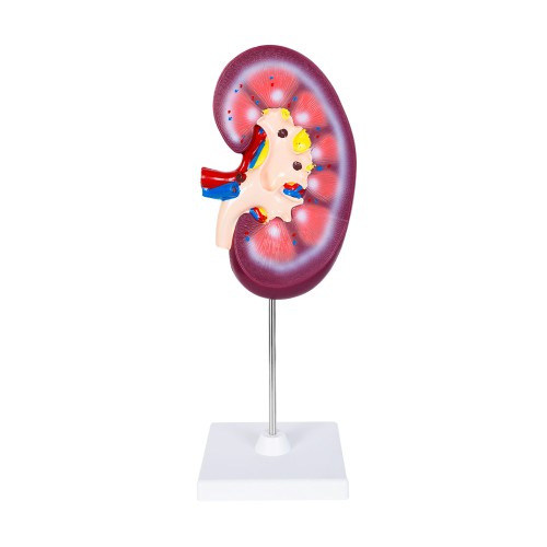 Anatomico Nefro CP 157 (CP157 - pvc - articulo promocional)