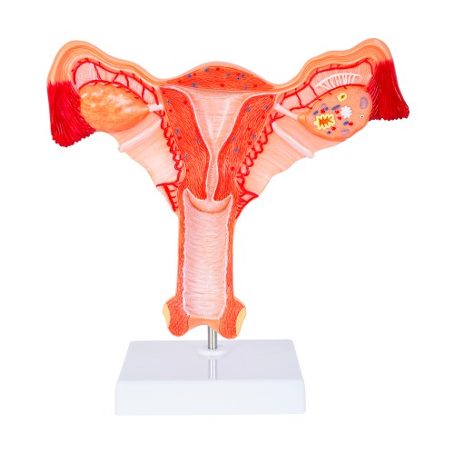 Anatomico Utero CP 158 (CP158 - pvc - articulo promocional)