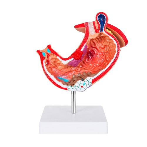 Anatomico Gastro CP 160 (CP160 - pvc - articulo promocional)