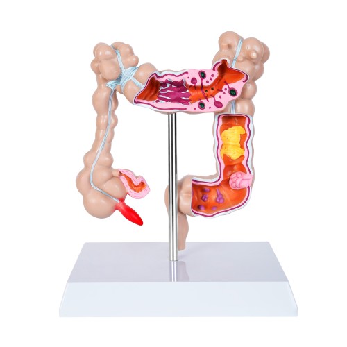 Anatomico Colon CP 163 (CP163 - pvc - articulo promocional)